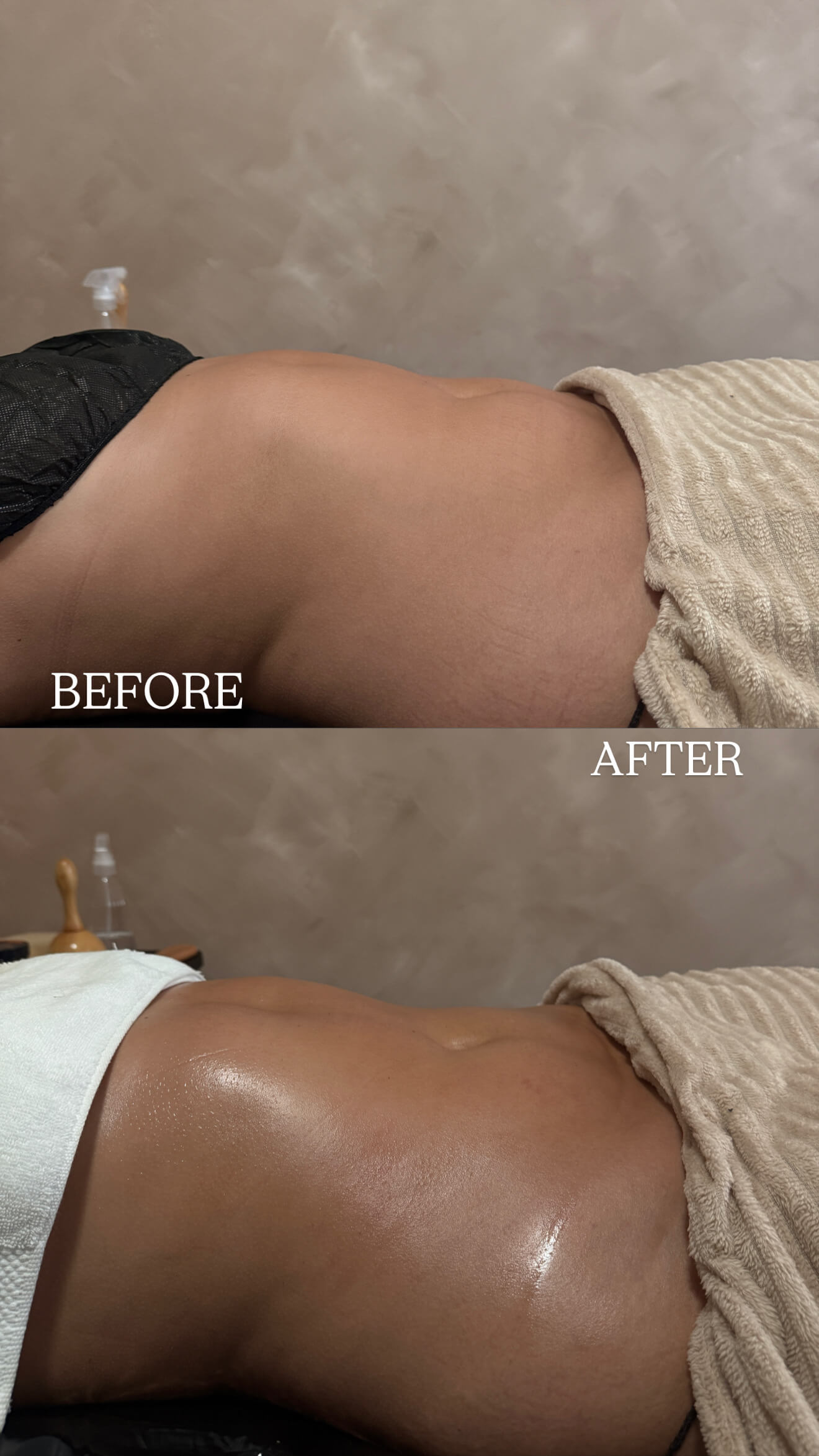 Lymphatic drainage result