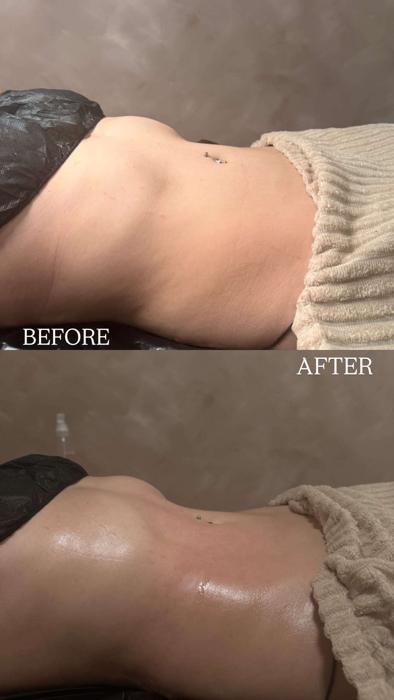 Lymphatic drainage result