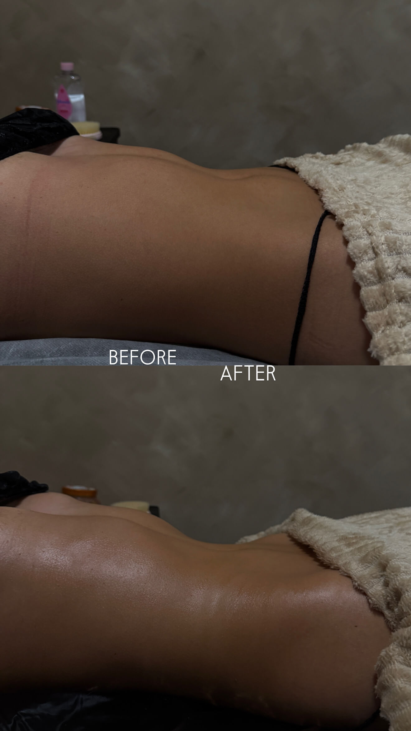 Lymphatic drainage result